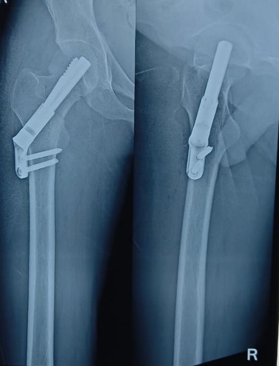 Best Orthopedic Hospital in Shela & South Bopal | Shela Orthopedic ...